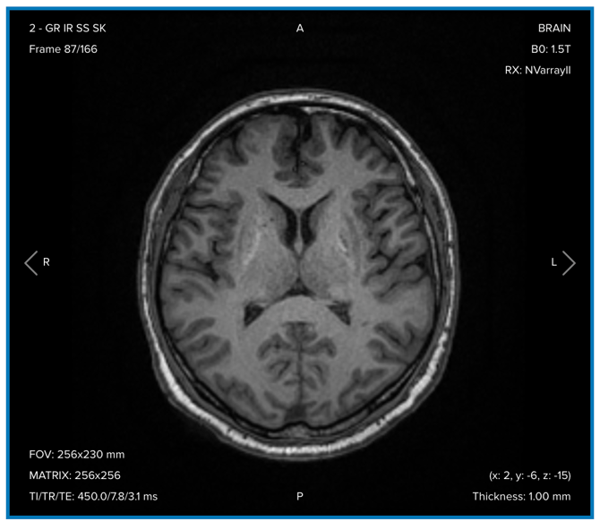 clinical-case-bravo