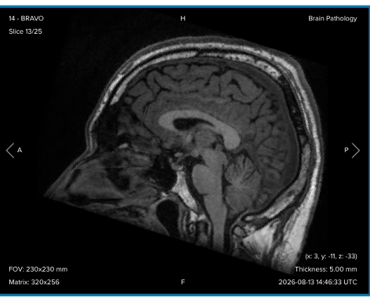 clinical-case-result
